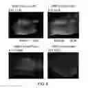 Fig. 09 - METHOD FOR OBTAINING PURKINJE PROGENITOR CELL BY USING NEPH3(65B13) AND E-CADHERIN