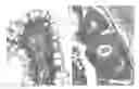 Fig. 01 - Methods and Nucleic Acids for the Detection of Metastasis of Colon Cell Proliferative Disorders