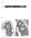 Fig. 03 - Methods and Nucleic Acids for the Detection of Metastasis of Colon Cell Proliferative Disorders