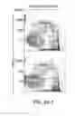 Fig. 17 - Methods and compositions for detecting receptor-ligand interactions in single cells