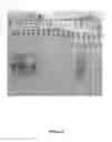 Fig. 06 - Synthesis of long-chain polyunsaturated fatty acids by recombinant cells