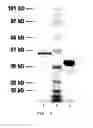 Fig. 06 - Composition, method, and kit for preparing plasmin