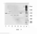 Fig. 08 - Composition, method, and kit for preparing plasmin