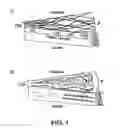 Fig. 02 - ISOLATED MYELOID-LIKE BONE MARROW CELL POPULATIONS AND METHODS OF TREATMENT THEREWITH