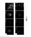 Fig. 06 - ISOLATED MYELOID-LIKE BONE MARROW CELL POPULATIONS AND METHODS OF TREATMENT THEREWITH