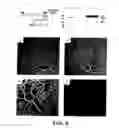 Fig. 09 - ISOLATED MYELOID-LIKE BONE MARROW CELL POPULATIONS AND METHODS OF TREATMENT THEREWITH