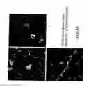 Fig. 35 - ISOLATED MYELOID-LIKE BONE MARROW CELL POPULATIONS AND METHODS OF TREATMENT THEREWITH
