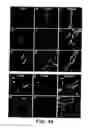 Fig. 45 - ISOLATED MYELOID-LIKE BONE MARROW CELL POPULATIONS AND METHODS OF TREATMENT THEREWITH