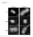 Fig. 18 - Vault complexes for facilitating biomolecule delivery