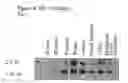 Fig. 15 - Method for the detection of endometriosis using an ME-2 antigen