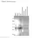Fig. 16 - Method for the detection of endometriosis using an ME-2 antigen