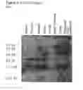 Fig. 17 - Method for the detection of endometriosis using an ME-2 antigen