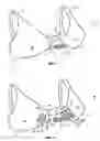 Fig. 02 - Cleavage enhancing brassiere