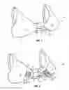 Fig. 03 - Cleavage enhancing brassiere
