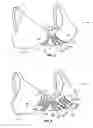 Fig. 04 - Cleavage enhancing brassiere