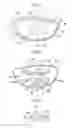 Fig. 02 - Golf club head