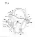 Fig. 05 - Tensioning device