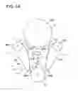 Fig. 06 - Tensioning device