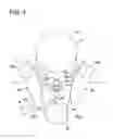 Fig. 07 - Tensioning device