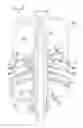 Fig. 04 - Centrifugal separator with snap fit separation cone