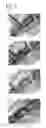 Fig. 05 - Tissue occluding agent comprising an IEIKIEIKIEIKI peptide