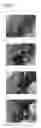 Fig. 06 - Tissue occluding agent comprising an IEIKIEIKIEIKI peptide
