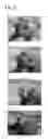 Fig. 09 - Tissue occluding agent comprising an IEIKIEIKIEIKI peptide