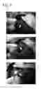 Fig. 10 - Tissue occluding agent comprising an IEIKIEIKIEIKI peptide