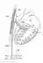 Fig. 01 - Heart help device, system, and method