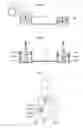 Fig. 14 - Heart help device, system, and method