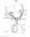 Fig. 49 - Heart help device, system, and method