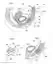Fig. 02 - Variable sling for urinary continence