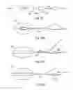 Fig. 13 - Variable sling for urinary continence