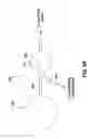 Fig. 06 - Remotely adjustable gastric banding system