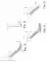 Fig. 08 - Minimally invasive implant and method