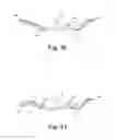 Fig. 11 - Minimally invasive implant and method