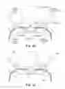 Fig. 12 - Minimally invasive implant and method