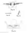 Fig. 15 - Minimally invasive implant and method
