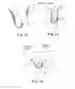 Fig. 16 - Minimally invasive implant and method