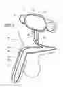 Fig. 04 - Inflatable penile prosthesis with spool valve