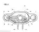 Fig. 06 - Inflatable penile prosthesis with spool valve
