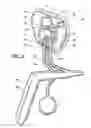 Fig. 19 - Inflatable penile prosthesis with spool valve