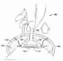 Fig. 01 - Expandable thoracic access port