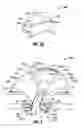 Fig. 03 - Expandable thoracic access port