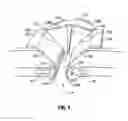 Fig. 04 - Expandable thoracic access port