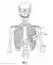 Fig. 02 - Expandable surgical access port