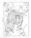 Fig. 03 - Retractor system for anterior cervical spine surgery