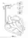 Fig. 02 - HEMODYNAMIC STABILITY DETECTION DURING ARRHYTHMIA USING RESPIRATION SENSOR
