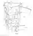 Fig. 05 - Dynamic stabilizing knee support system