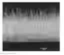 Fig. 01 - Medical device applications of nanostructured surfaces